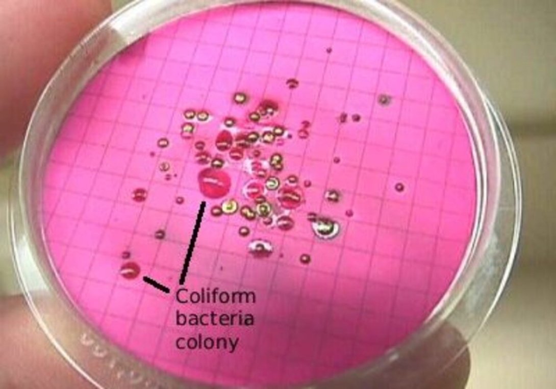 Microscopic view of fecal coliform bacteria